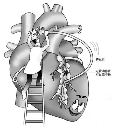 猝死率高 三大職業(yè)人群要小心提防 超聲骨密度測試儀